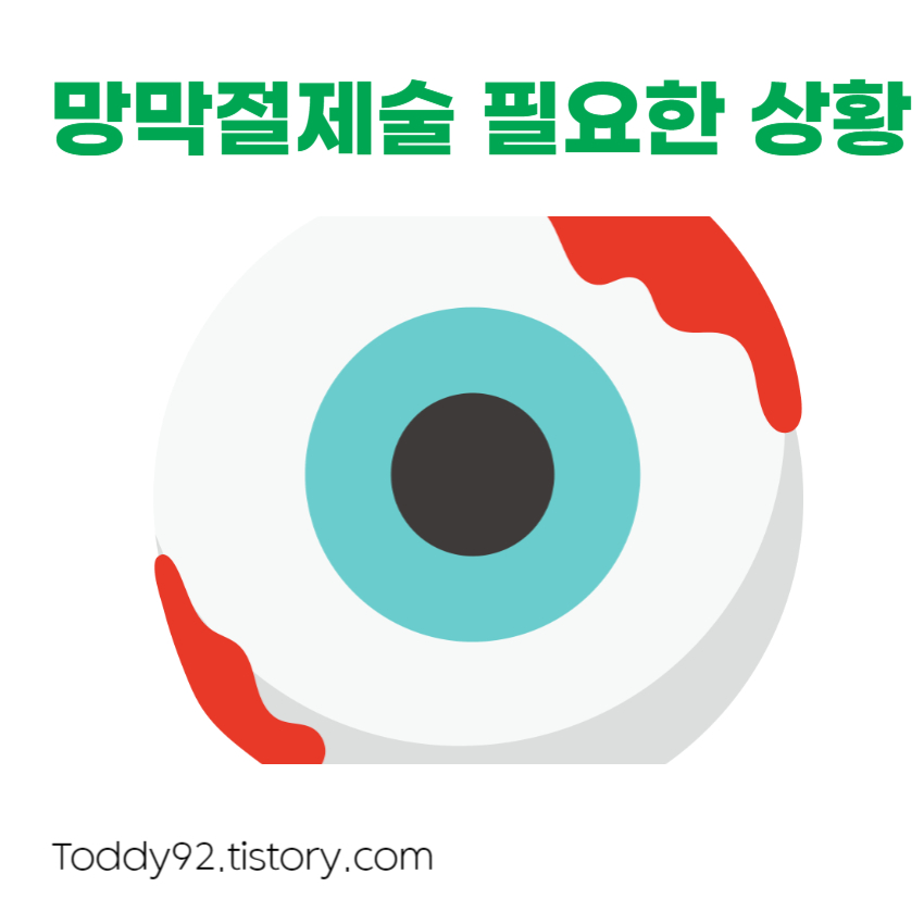 망막절제술 필요한 상황