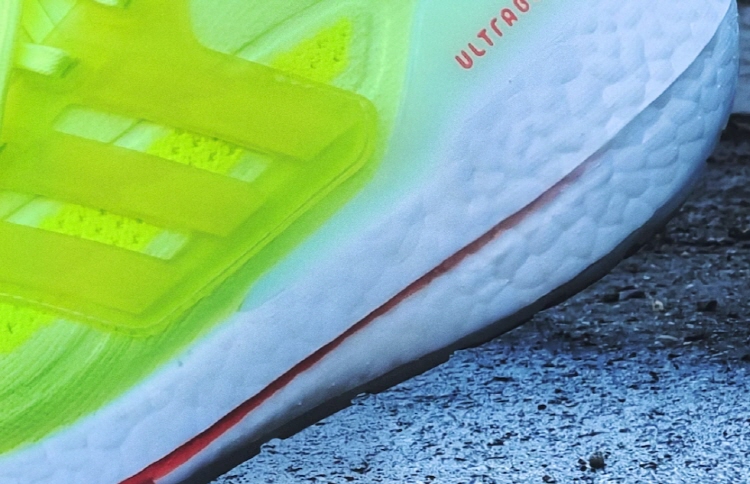 족저 근막염 자가치료