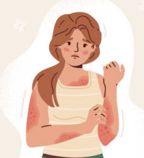 대상포진 초기증상 치료방법 예방법 총정리