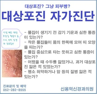 대상포진 치료방법에 대한 총정리 건강 질병관리_9