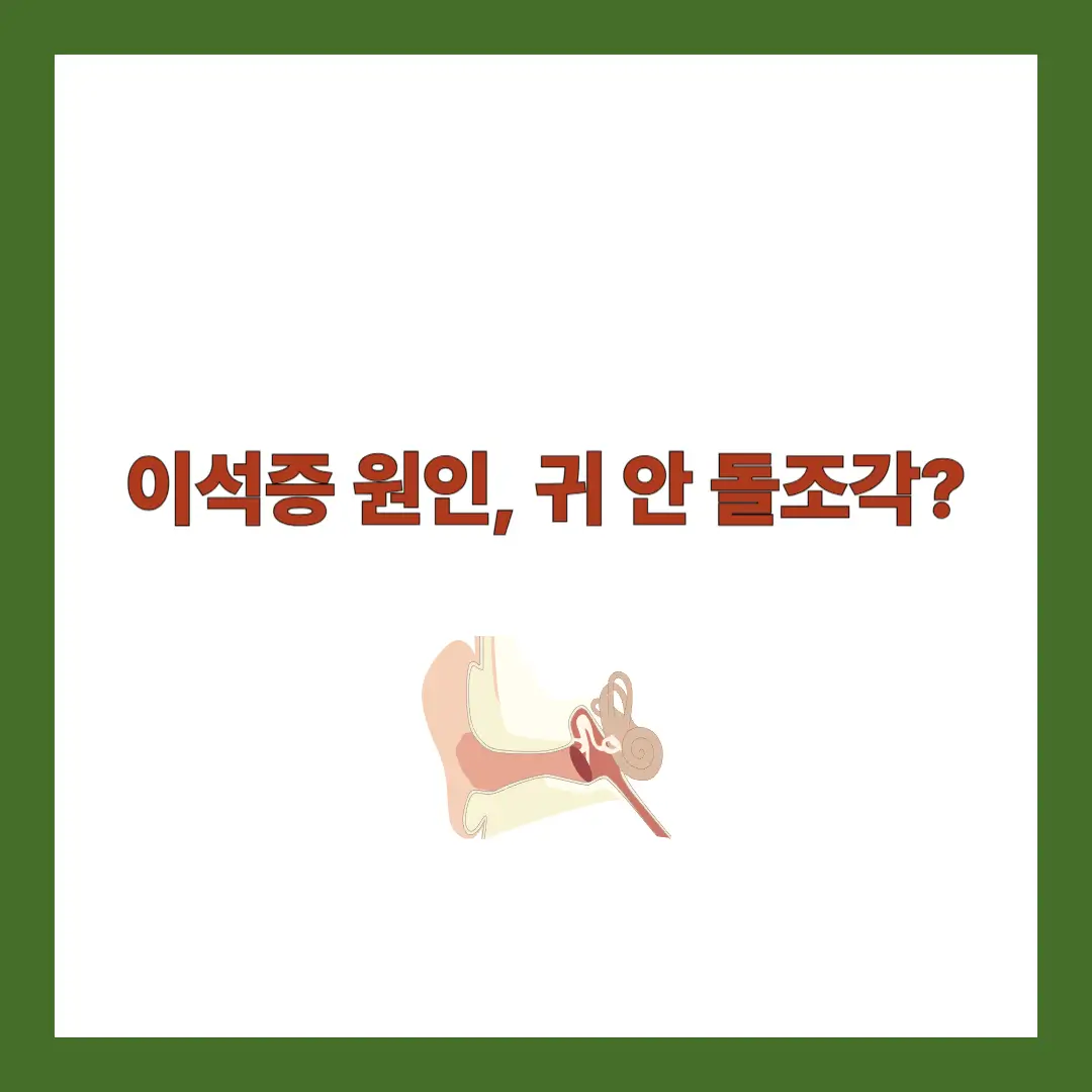 이석증 원인