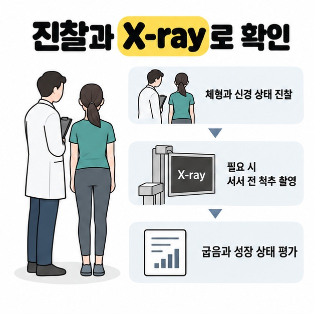 의사가 선 자세의 사람을 관찰하는 모습 옆에 체형과 신경 상태 진찰, 필요한 전 척추 X-ray 촬영, 굽음과 성장 상태 평가를 순서대로 보여주는 도식