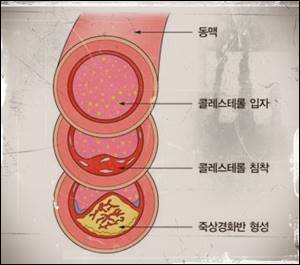 혈관_속_단면도
