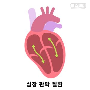 기립성 어지럼증