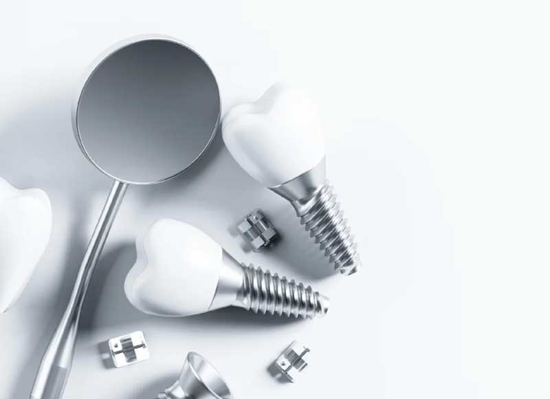 치아와 임플란트 관련 이미지