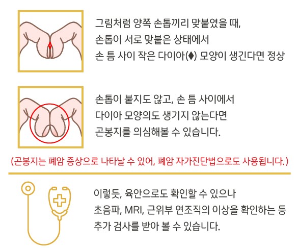 폐섬유증