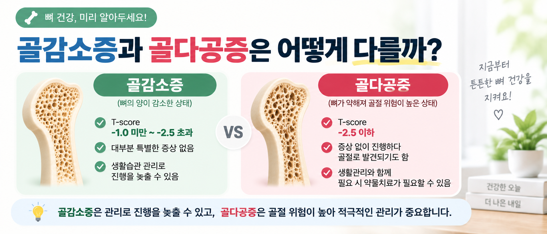골감소증과 골다공증 T-score 기준 및 차이 비교