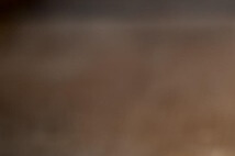 키 크는 영양제