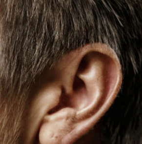귀에서 삐소리가 나는 이유