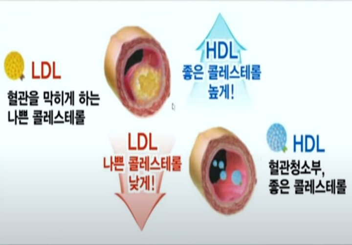 이상지질혈증-혈관상태-썸네일