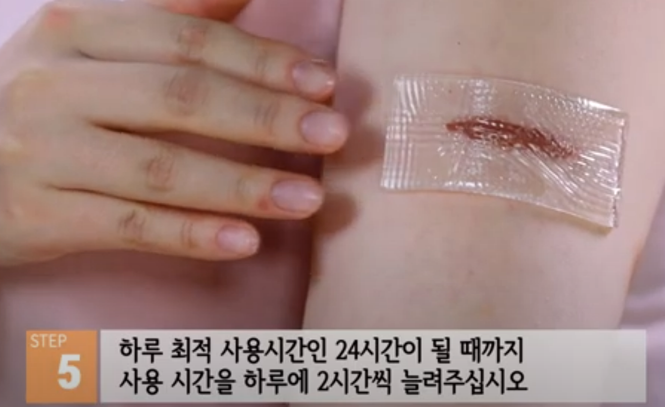시카케어 겔시트 약국에서 사서, 제왕절개 배 흉터 관리했어요.