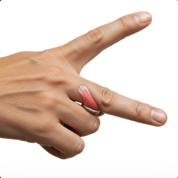 손가락 마디 아픈 이유 5가지4