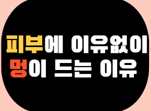 이유없이 멍이 드는 이유