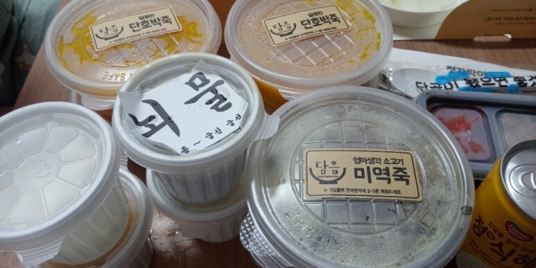 하안검 수술 후기