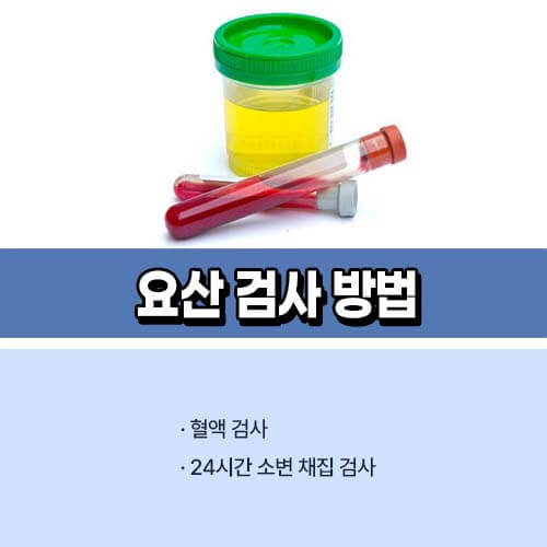 요산수치_낮추는_법