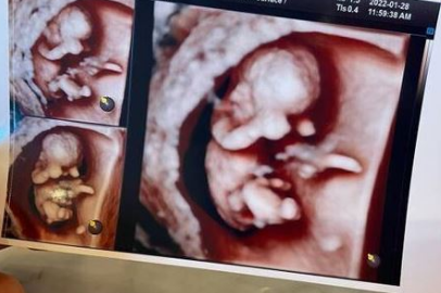 홍현희 제이쓴 득남