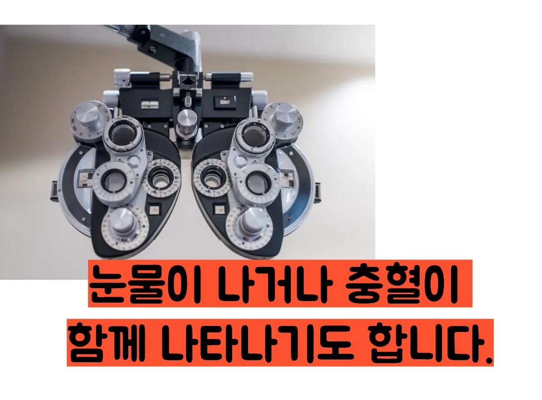 눈에 이물질이 낀것 같은 증상