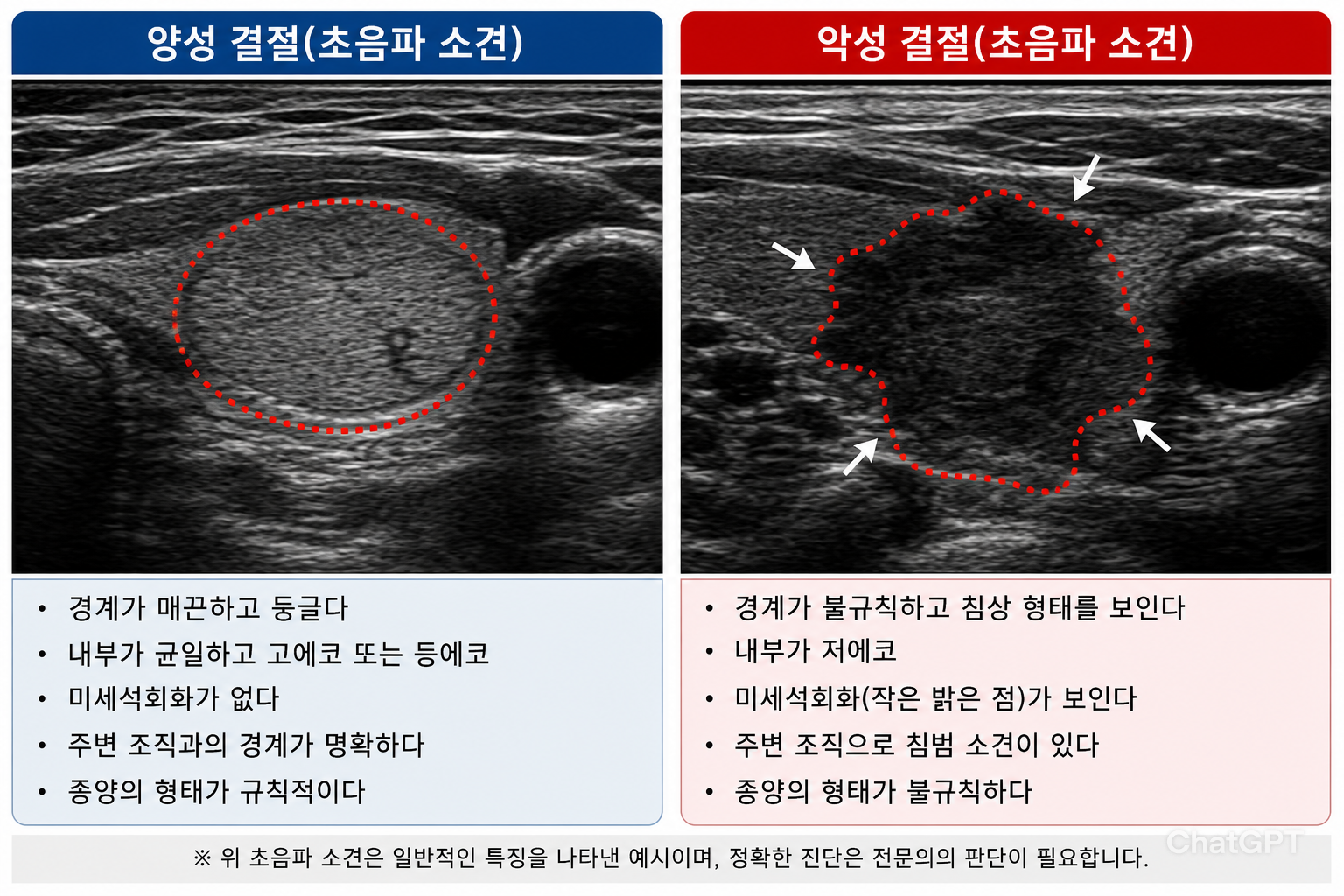 양성과 악성