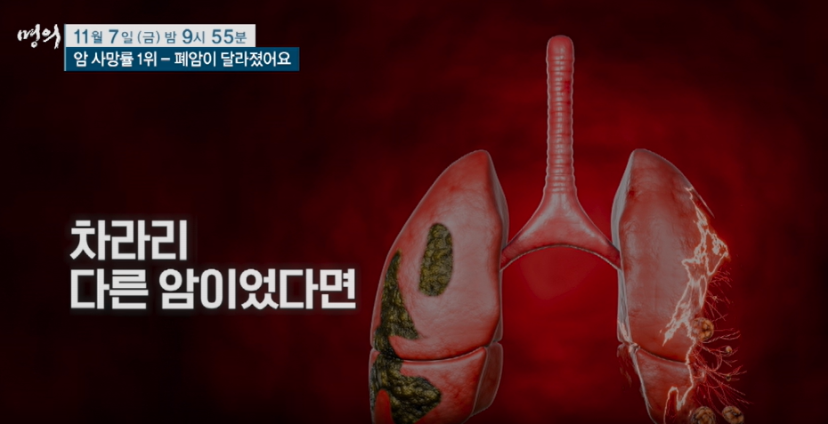 명의 폐암이 달라졌어요