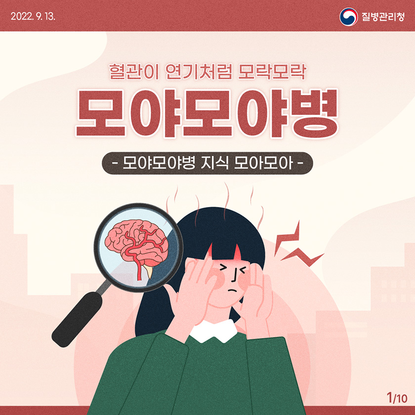 모야모야병 유전 증상 원인 치료 수술