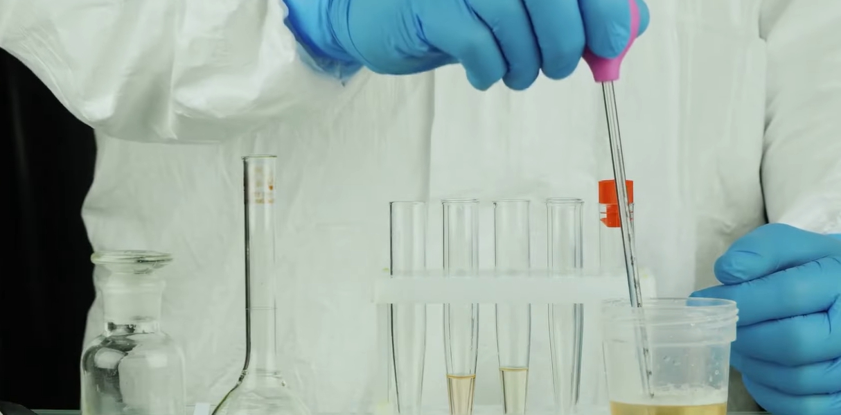 방광염 증상