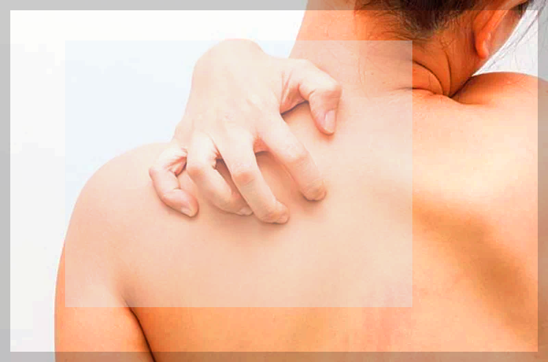 대상포진 후유증 가려움_