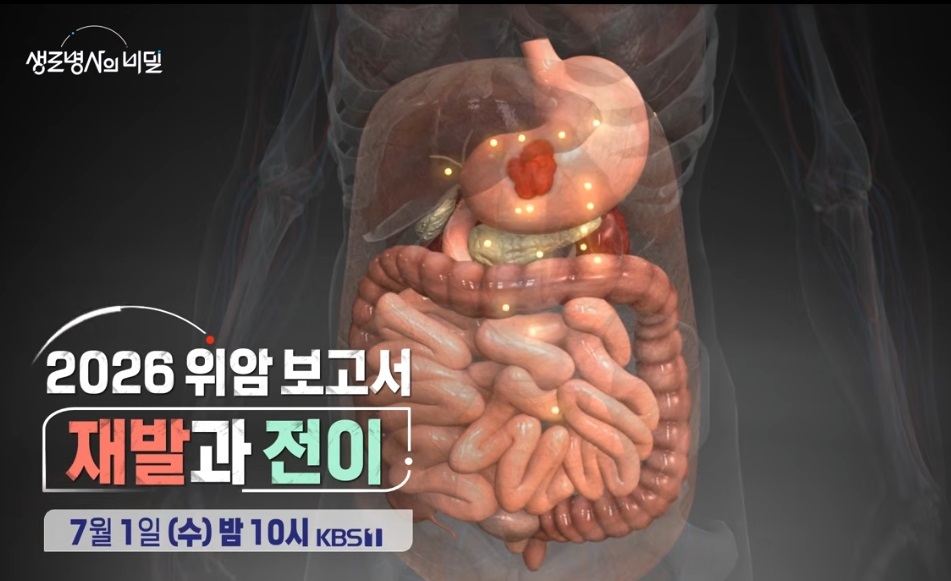 생로병사의-비밀-위암보고서-재발과-전이