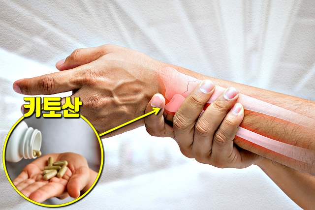 키토산 효능 부작용, 골다공증, 질활별 피해야할 건강식품,건강,팁줌 매일꿀정보