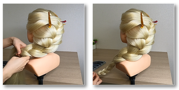 엘사머리 시술과정3