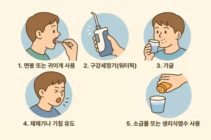집에서 편도결석 빼는법
