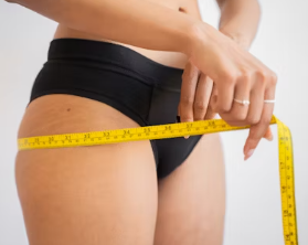 비만 치료 방법 진단기준 예방법