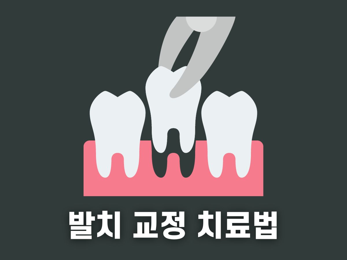 발치 교정 치료법