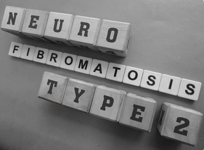 신경섬유종 초기 증상, 혹시 나도? 놓치면 안 되는 신호