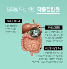 담적병 증상