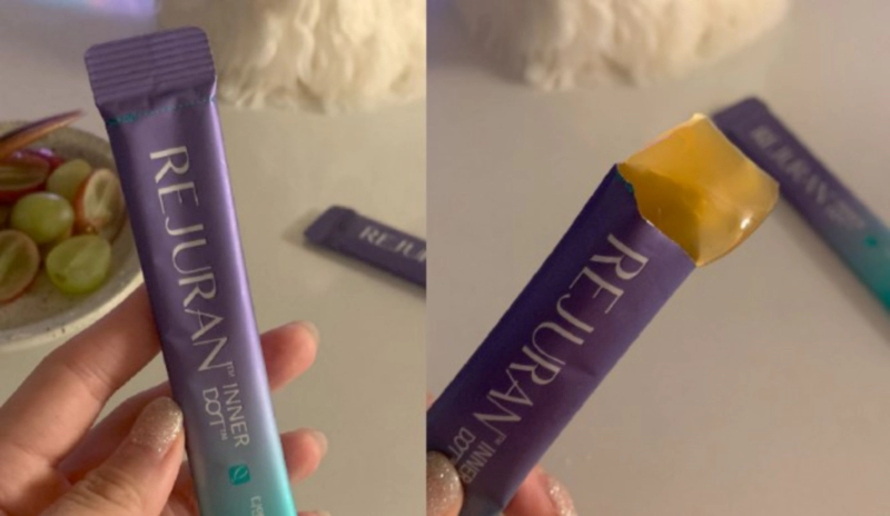 먹는 리쥬란 추천