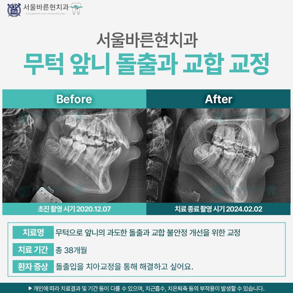 부산해운대교정치과