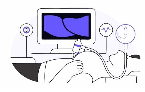 역류성식도염 치료 과정