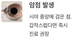 황반변성 초기 암점발생