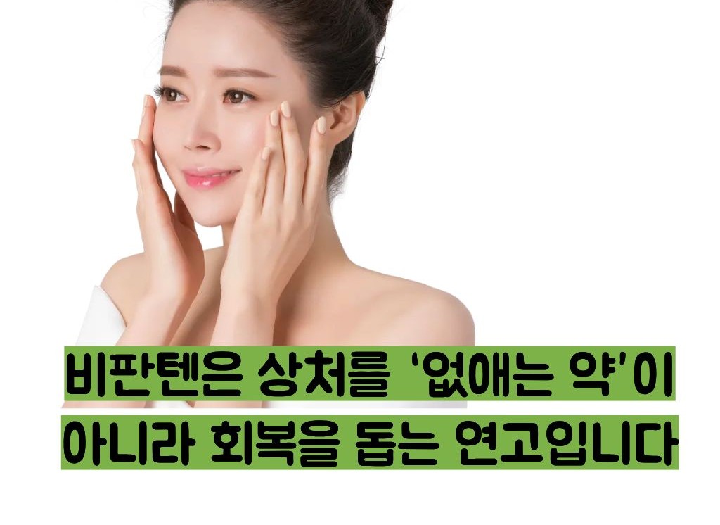 비판텐 연고 효능