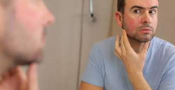 피부 붉은반점 20