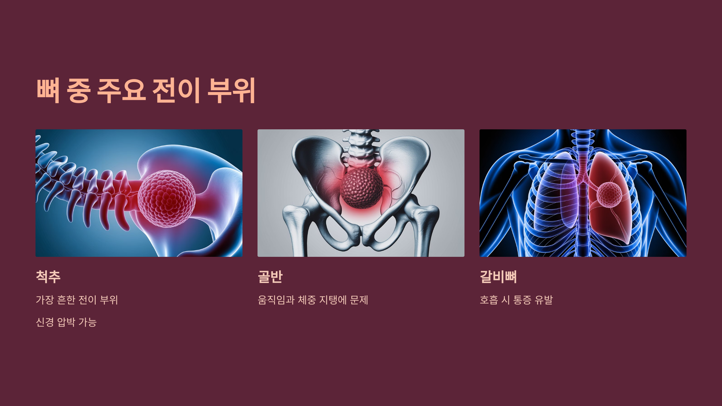 뼈 중 주요 전이 부위