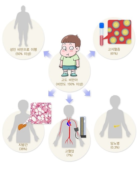 소아비만 관련 합병증