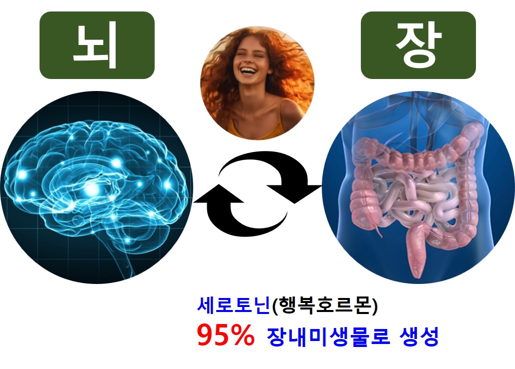 과민성대장증후군