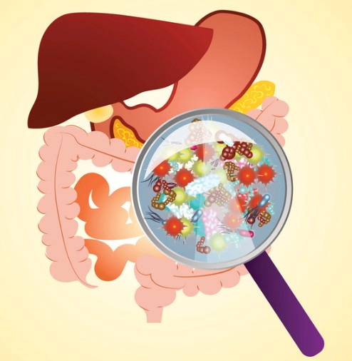 장내 미생물 종류 4가지 및 장내 미생물 불균형 만성피로 비만 연관성