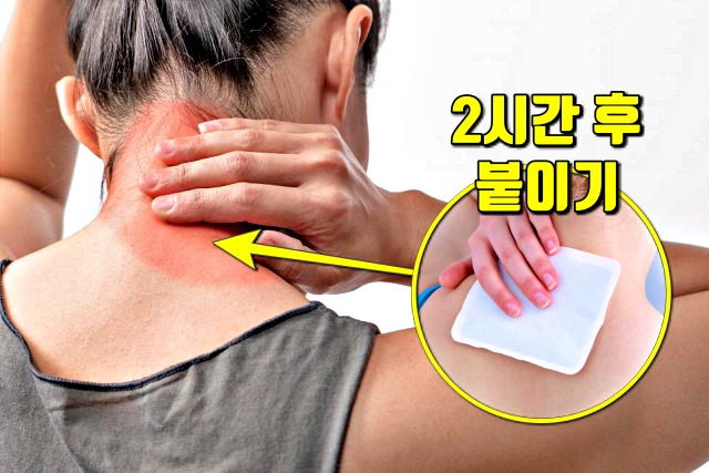 올바른 파스 붙이는 법,파스 붙이는 시간,파스 붙인자리 가려움 부작용 치료법,건강