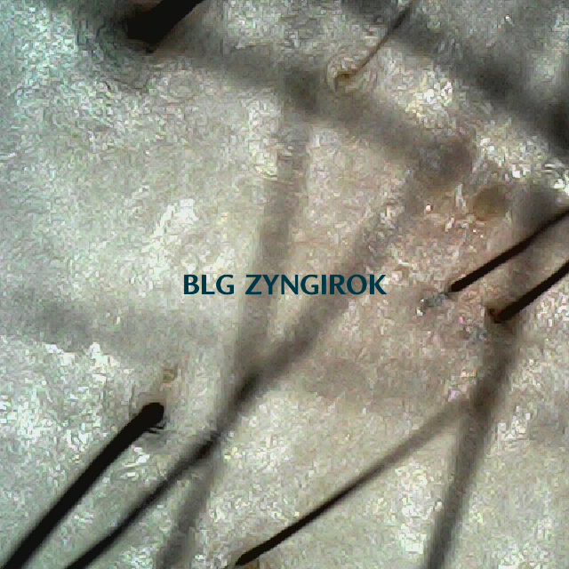 탈모 극복 프로젝트 - 정수리와 이마 사이 두피 모습이다.