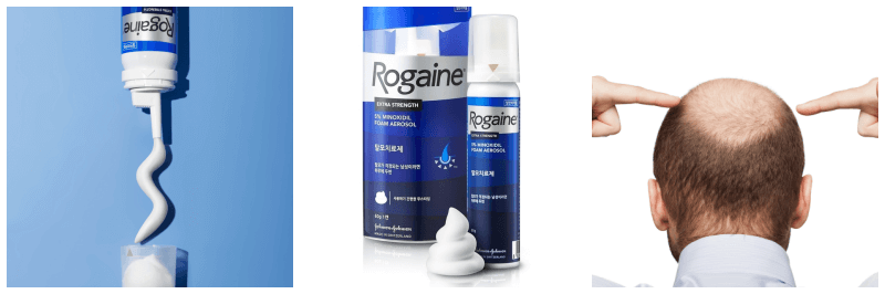 로게인폼, 탈모 사진