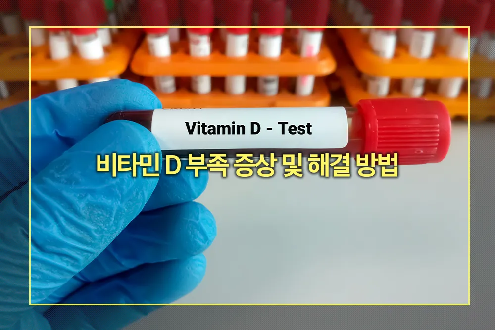 비타민 D 부족 증상 및 해결 방법