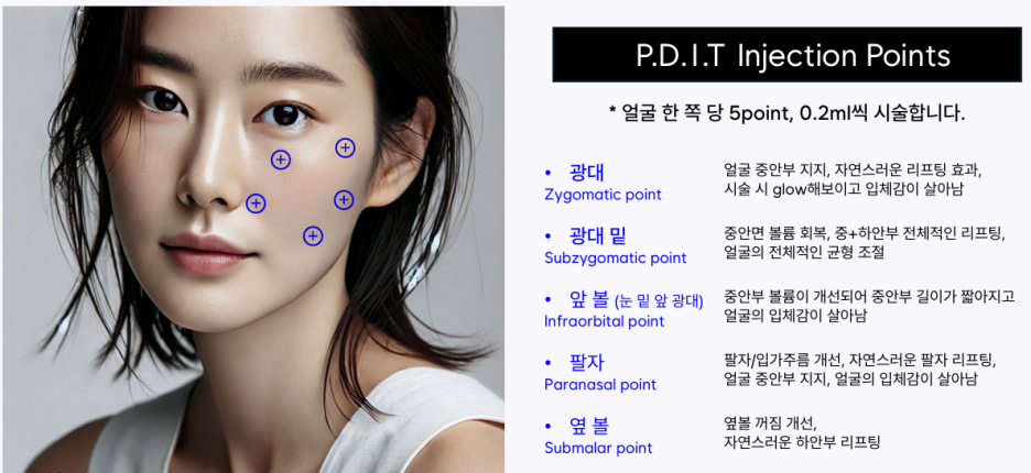 힐로웨이브 팔자주름 필러 원리 효과 정리