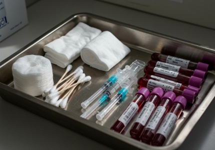 난소암 병기 및 치료법